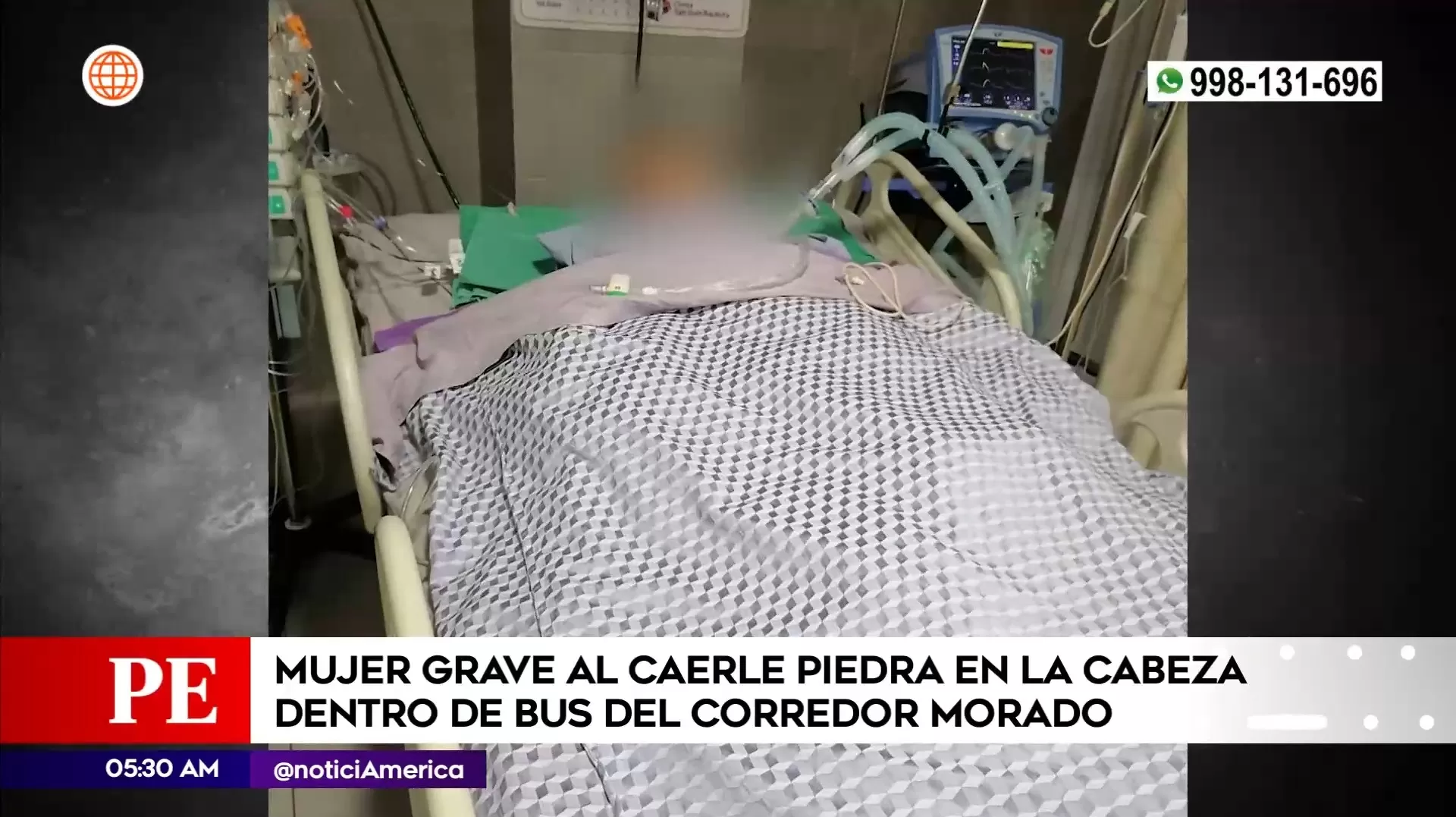 Mujer fue operada del cerebro | América Noticias