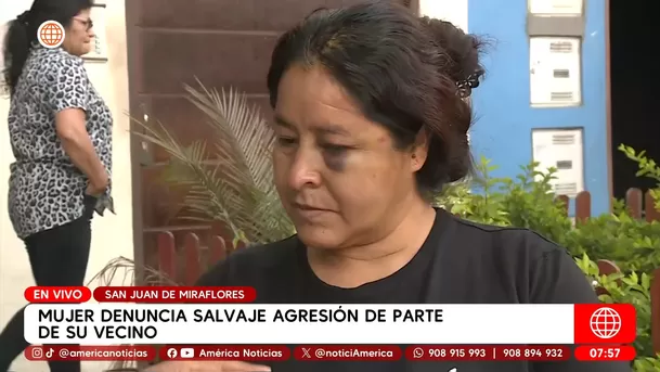 Mujer denuncia salvaje agresión de parte de su vecino en San Juan de Miraflores. Foto: América Noticias