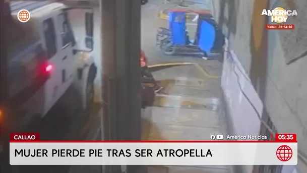 Mujer pierde un pie tras ser atropellada por un tráiler en el Callao. Foto: América Noticias