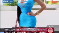 Mujer plástica: venezolana fue operada numerosas veces para ser una ‘Barbie’