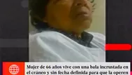 Mujer que vive con una bala en su cabeza no tiene fecha de operación