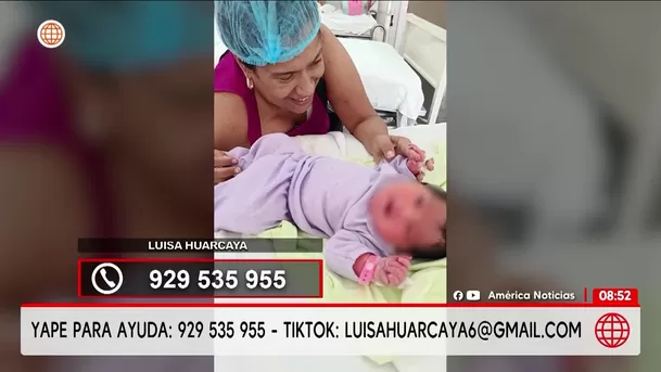 Mujer solicita ayuda para operarse la vista. Foto: América Noticiasv
