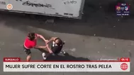 Mujer sufre graves cortes en el rostro tras pelea en Surquillo