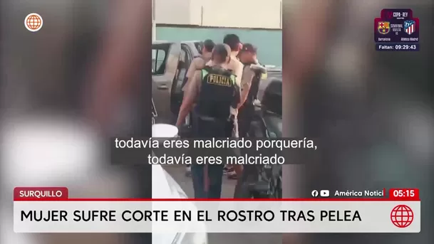 Mujer sufre graves cortes en el rostro tras pelea en Surquillo. Foto: América Noticias