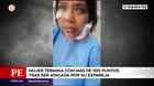 Mujer terminó desfigurada tras ser atacada por su expareja