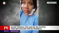 Mujer desfigurada tras ser atacada por expareja en San Martín de Porres. Foto y video: América Noticias