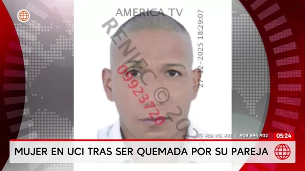 Mujer en UCI tras ser quemada por su pareja en Barrios Altos. Foto: América Noticias