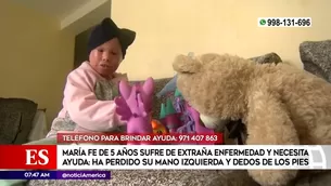 María Fe es el único caso de ictiosis arlequín en el Perú.