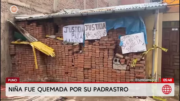 Niña fue quemada por su padrastro en Puno. Foto: América Noticias