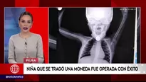 Luego de varias horas de intervención, los médicos de dicho nosocomio sustrajeron la moneda, salvándole la vida a la menor de edad