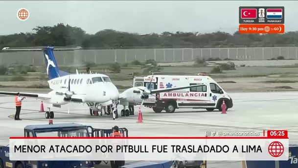 Niño de 4 años fue atacado por perro pitbull en Chiclayo. Foto: América Noticias Niño de 4 años fue atacado por perro pitbull en Chiclayo. Foto: América Noticias