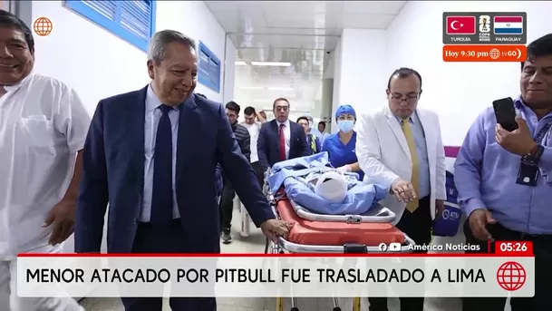 Niño de 4 años fue atacado por perro pitbull en Chiclayo. Foto: América Noticias Niño de 4 años fue atacado por perro pitbull en Chiclayo. Foto: América Noticias