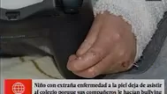 Niño 'mariposa' dejó de asistir al colegio porque era víctima de bullying