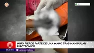 Niño perdió parte de una mano tras manipular rata blanca