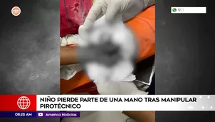 Foto y video: América TV       