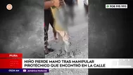 Niño pierde la mano tras manipular pirotécnico en Piura