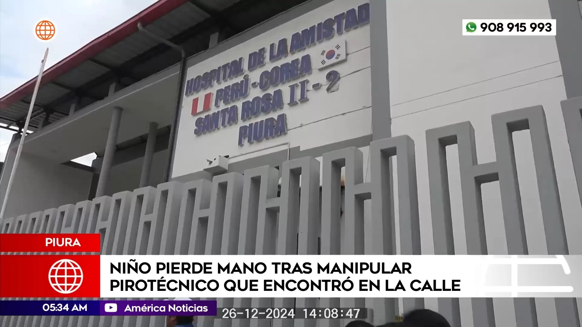 Niño pierde la mano tras manipular pirotécnico que encontró en una calle de Piura. Foto: América Noticias Niño pierde la mano tras manipular pirotécnico que encontró en una calle de Piura. Foto: América Noticias