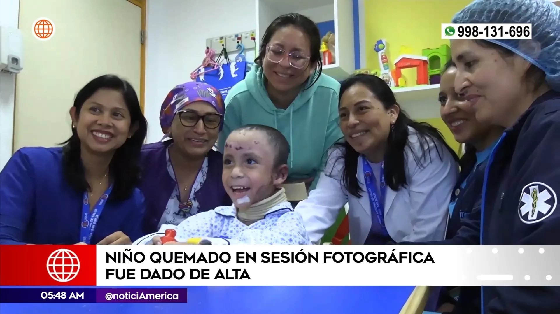 Niño que sufrió quemaduras en sesión fotográfica fue dado de alta. Foto: América Noticias