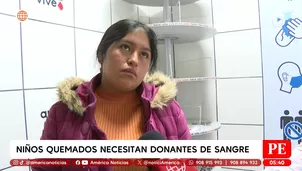 Niños quemados en Huánuco necesitan donantes con urgencia. Foto y video: América Noticias