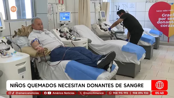 Niños quemados en Huánuco necesitan donantes con urgencia. Foto: América Noticias Niños quemados en Huánuco necesitan donantes con urgencia. Foto: América Noticias