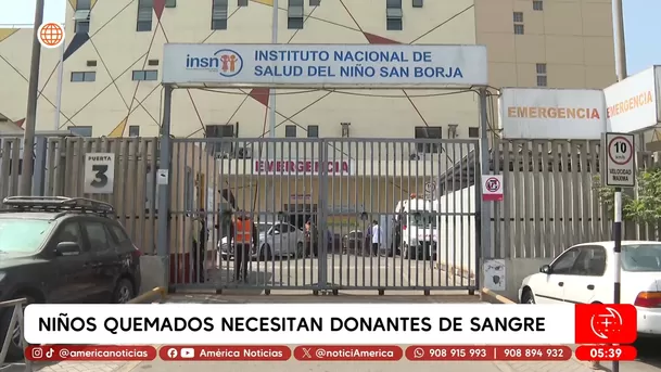 Niños quemados en Huánuco necesitan donantes con urgencia. Foto: América Noticias Niños quemados en Huánuco necesitan donantes con urgencia. Foto: América Noticias