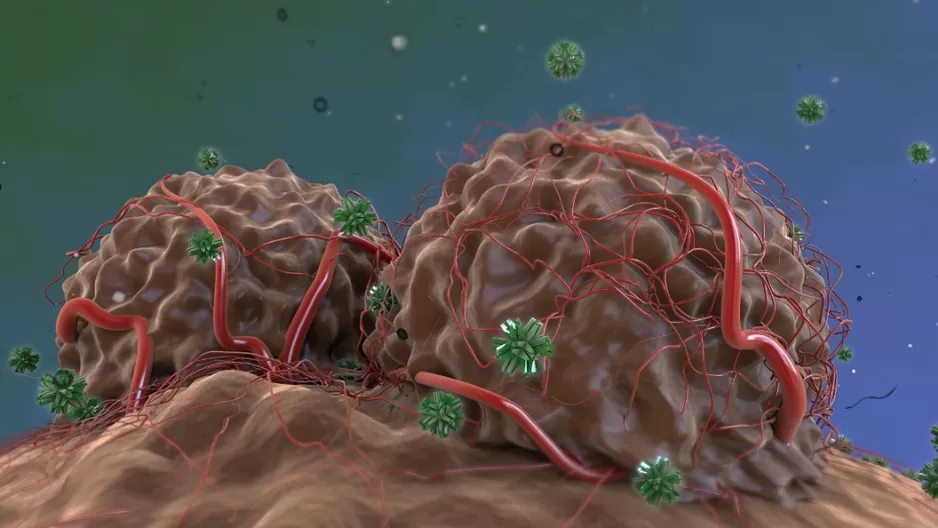 Nueva prueba no invasiva para detectar el cáncer oral. Foto: Cell Reports Medicine