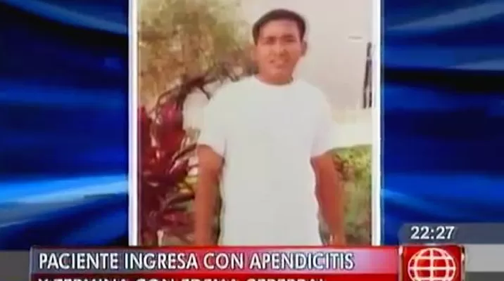 Paciente ingresó al Hospital Santa Rosa por apendicitis y terminó con un edema cerebral Paciente ingresó al Hospital Santa Rosa por apendicitis y terminó con un edema cerebral