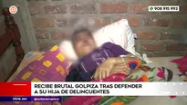 Padre golpeado tras defender a su hija de delincuentes. Foto y video: América Noticias