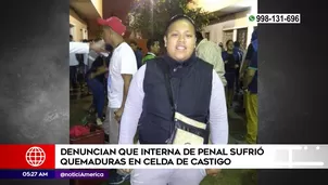 Interna del penal de Chorrillos sufrió quemaduras. Foto y video: América Noticias