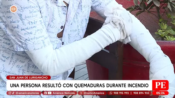 Una persona resultó con quemaduras durante incendio en San Juan de Lurigancho. Foto: América Noticias Una persona resultó con quemaduras durante incendio en San Juan de Lurigancho. Foto: América Noticias