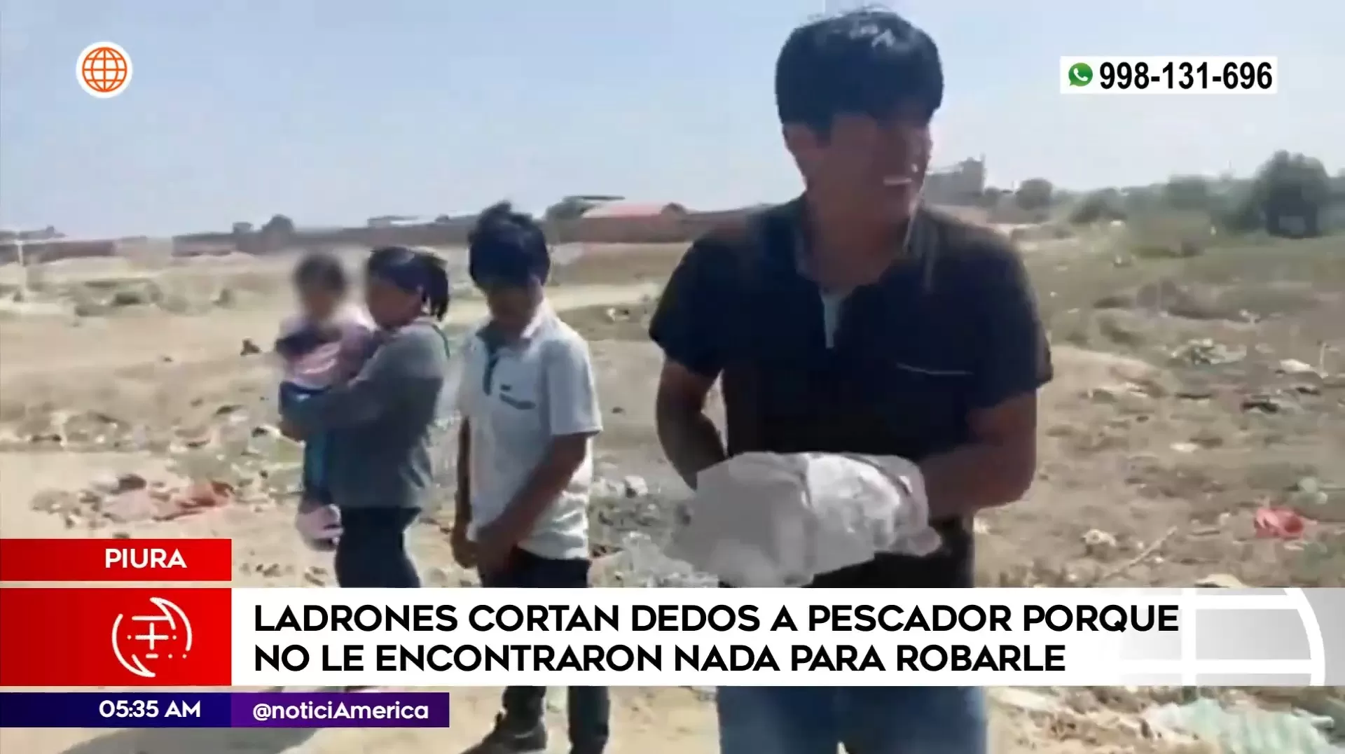 Pescador necesita operación | Imagen: América Noticias