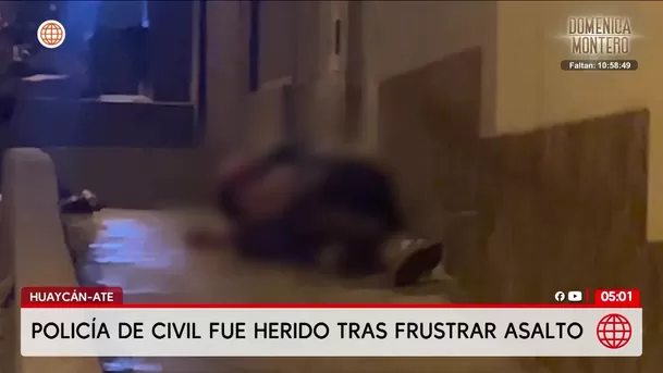 Policía de civil es herido tras asalto en Ate. Foto: América Noticias