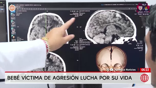 Dictan prisión preventiva contra padres por presunto maltrato a su bebé. Foto: América Noticias