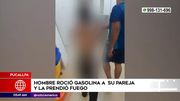 Hombre prendió fuego a su pareja en Pucallpa. Foto: América Noticias