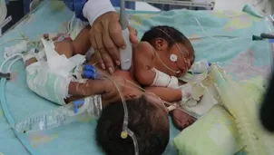 Las bebés reciben toda la atención médica. Foto: Referencial/archivo El Comercio