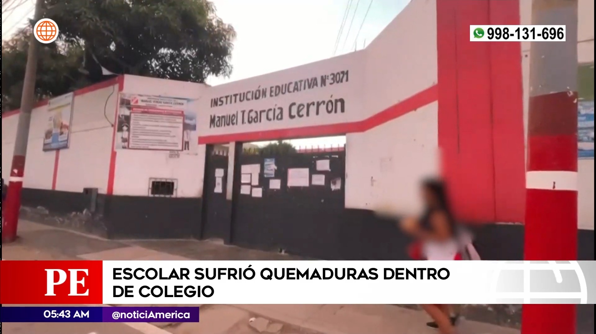 Escolar sufrió quemaduras en su colegio en Puente Piedra. Foto: América Noticias