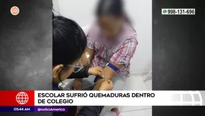 Escolar sufrió quemaduras en su colegio en Puente Piedra. Foto y video: América Noticias