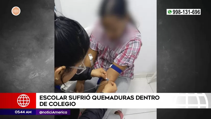 Puente Piedra: Escolar sufrió graves quemaduras dentro de su colegio