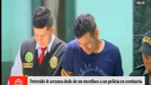 Doctores no pudieron unir el dedo que fue mordido por el delincuente