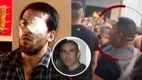 Punta Hermosa: Acusan a seguridad de empresario Omar Machi de desfigurar a joven en discoteca - Foto y video: América Noticias