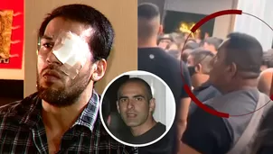 Punta Hermosa: Acusan a seguridad de empresario Omar Machi de desfigurar a joven en discoteca - Foto y video: América Noticias