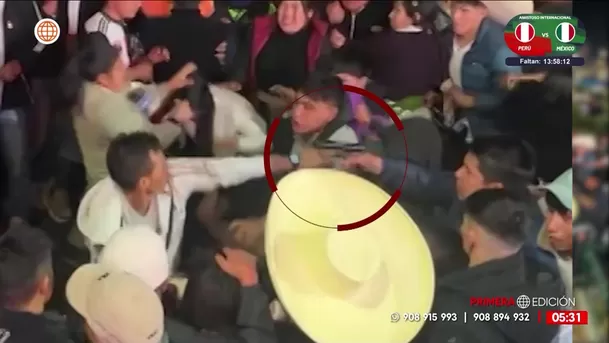 Rondero resulta herido tras disparo en fiesta de La Libertad. Foto: América Noticias Rondero resulta herido tras disparo en fiesta de La Libertad. Foto: América Noticias