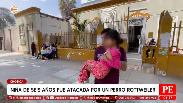 Niña de seis años fue atacada por un perro rottweiler en Chosica. Foto: América Noticias