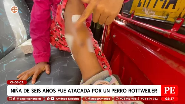 Niña de seis años fue atacada por un perro rottweiler en Chosica. Foto: América Noticias