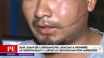 Hombre fue desfigurado en SJL.