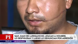 Hombre fue desfigurado en SJL.