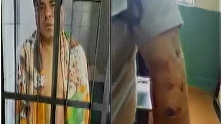 Fernández García, agresor del efectivo policial, atacó al suboficial mordiéndole el brazo izquierdo hasta provocarle cortes y moretones. Fernández García, agresor del efectivo policial, atacó al suboficial mordiéndole el brazo izquierdo hasta provocarle cortes y moretones.