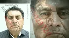 San Martín de Porres: Pintor murió tras caer del segundo piso de policlínico 