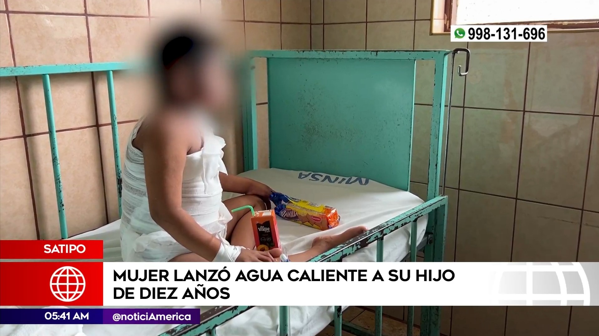 Madre quemó a su hijo en Satipo. Foto: América Noticias