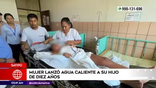 Madre quemó a su hijo en Satipo. Foto y video: América Noticias